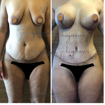 Slider image (10) Dr. Zeki Yasar Clinic